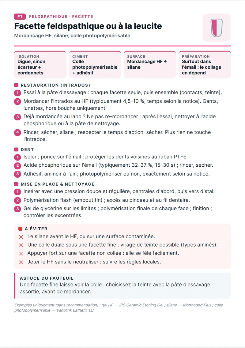 Fiche de protocole F1 : facettes en céramique feldspathique